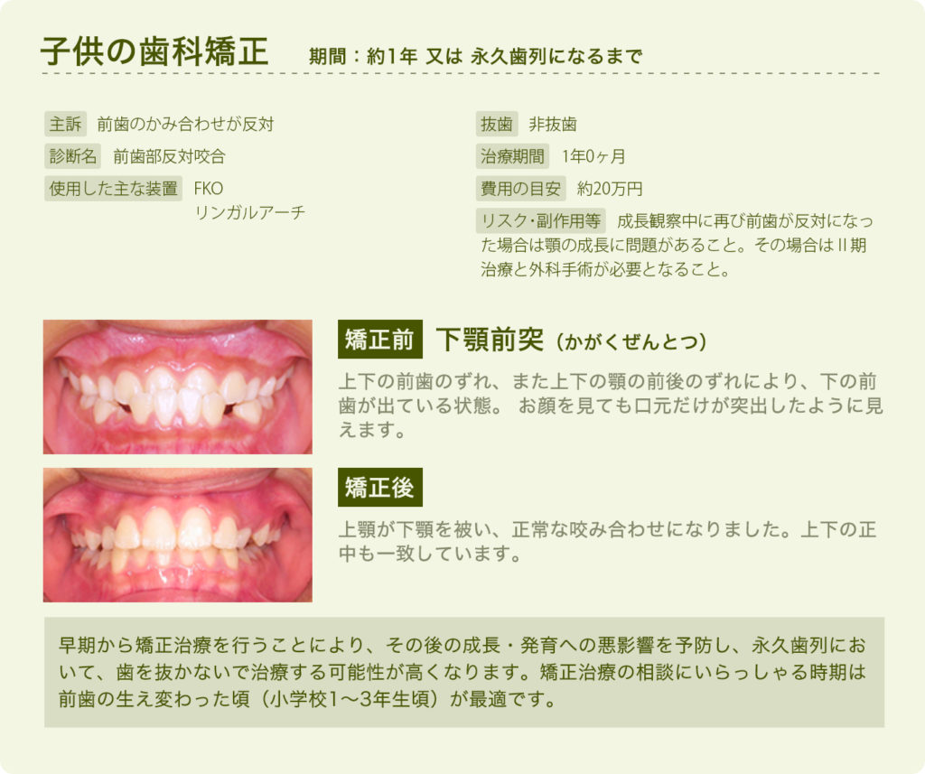 子供の矯正治療 本田淳也デンタルデザインクリニック 公式webサイト